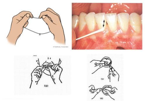 آموزش استفاده صحیح از نخ دندان 