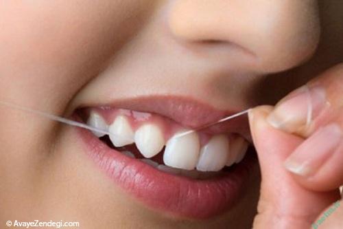 آموزش استفاده صحیح از نخ دندان