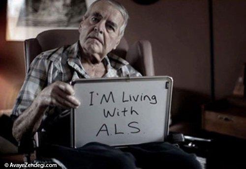 همه چیز در مورد بیماری ALS 