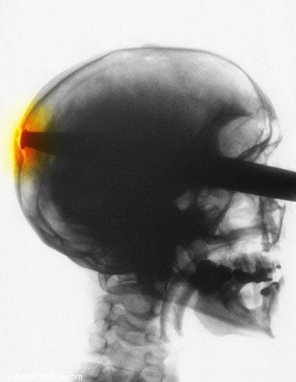  عجیب ترین عکس‌های رادیولوژی (16+) 