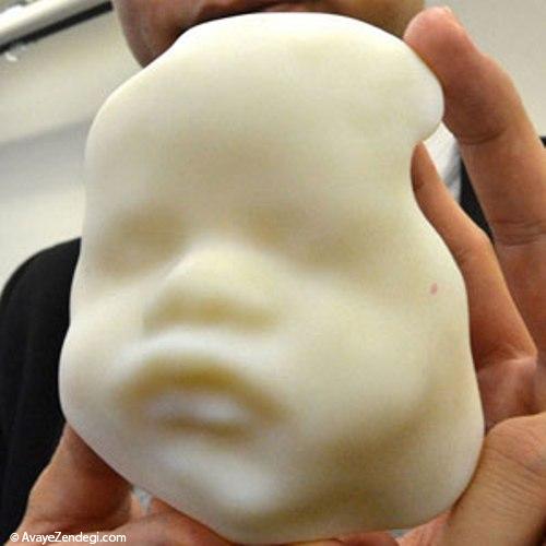 قبل از به دنیا آمدن کودکتان، صورتش در دستان شما