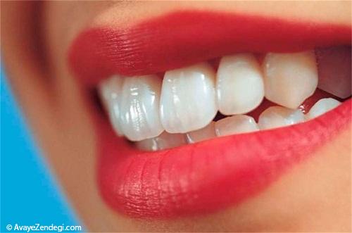چگونه از پوسیدگی دندان ها جلوگیری کنیم؟