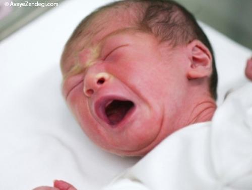 در رشد نوزادان نارس چربی شیر انسان چه تاثیری دارد؟