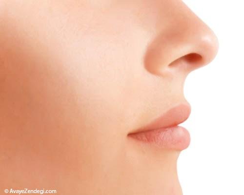 روش موثر از بین بردن چربی پوست بینی