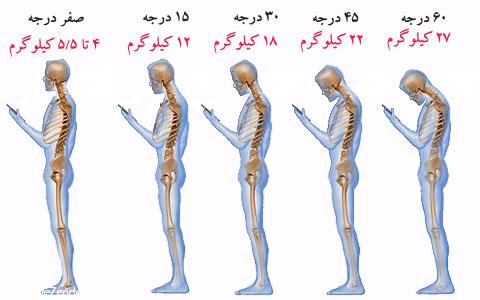 ۲۷ کیلوگرم فشار بر مهره های گردن به دلیل استفاده از موبایل
