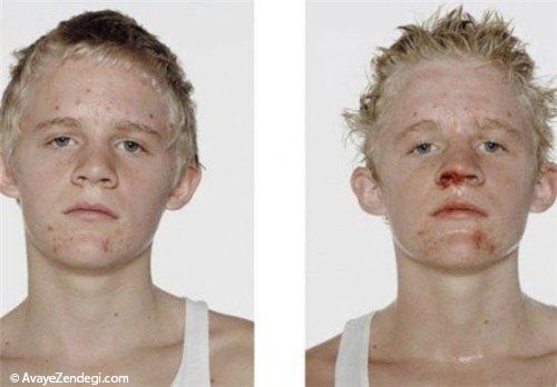  بوکسورهای جوان قبل و بعد از مبارزه 