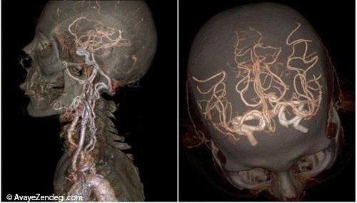  مغز، استخوان و عروق به شکلی که تاکنون ندیده‌اید 
