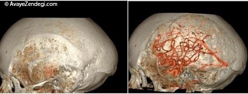  مغز، استخوان و عروق به شکلی که تاکنون ندیده‌اید 