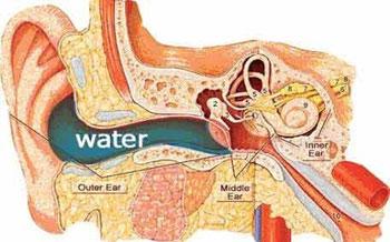 چه چیزی باعث ایجاد زخم در گوش می شود؟