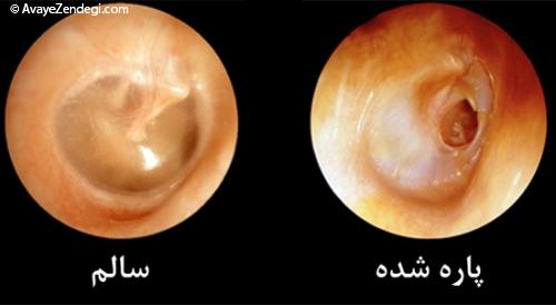 پرده گوشتان را کنار نزنید