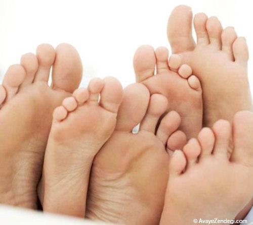 چه بیماری هایی را می توان از روی پا تشخیص داد؟