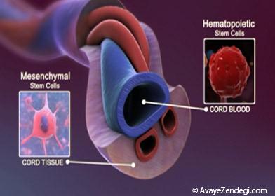 سلول های بنیادی خون بند ناف انسان