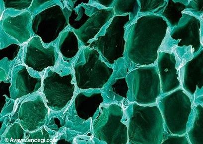 تصاویر میکروسکوپی دیدنی از درون بدن