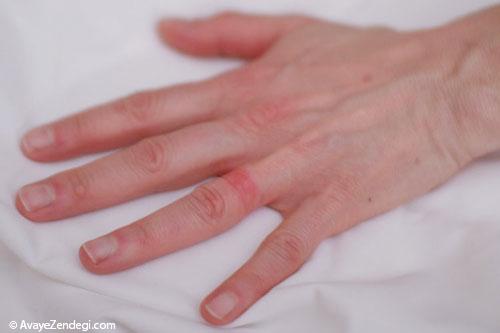  10 نکته درباره حساسیت پوستی به زیورآلات 