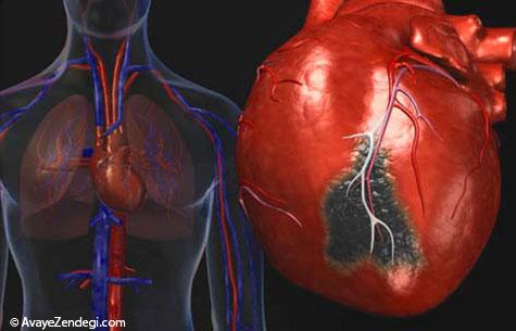  حمله قلبی، سکته مغزی یا آنژین؟ علائم را بشناسید 