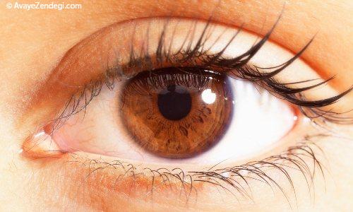 ردپای 5 بیماری بدن در چشم ها