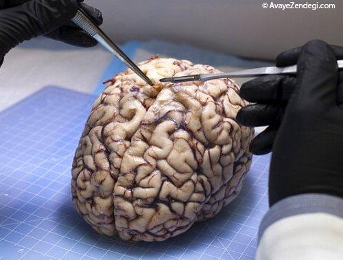  43 حقیقت جالب درباره مغز انسان که نمی دانستید! (2) 