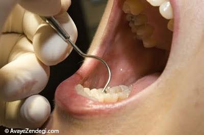 بدبویی دهان و درمان آن در طب سنتی